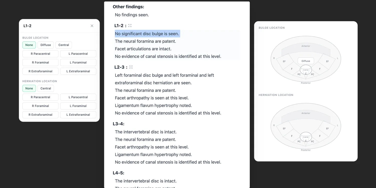 Skia interface with click based findings on the left, including disc bulge and herniation selectors, and the generated report text on the right